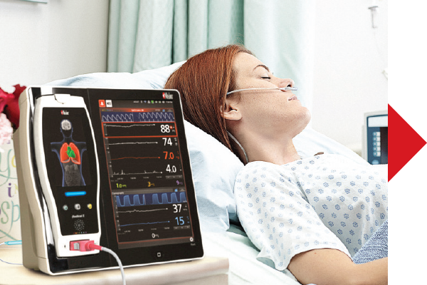 Masimo - Configurar umbrales de alarma - mujer acostada en la cama del hospital con el dispositivo