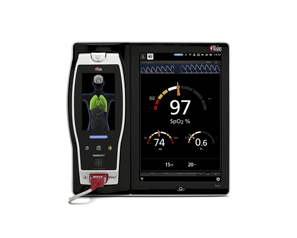 Monitor de pacientes Root con Radical-7 acoplado.