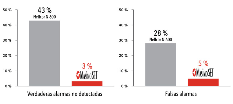 Masimo - Rendimiento en condiciones de movimiento y baja perfusión