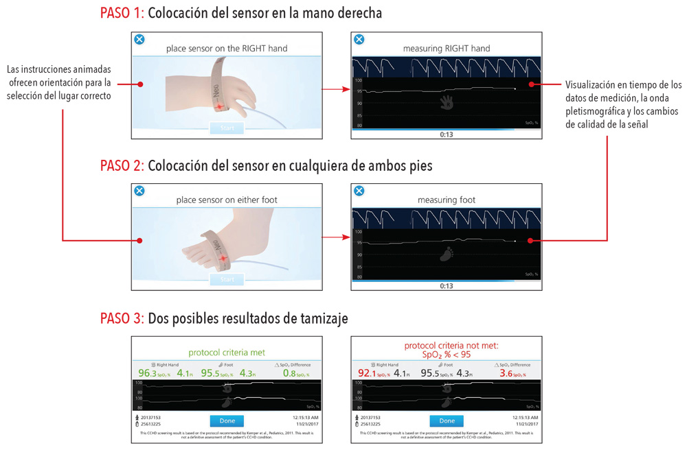 Masimo - Las instrucciones paso a paso de Eve mejoran la constancia y la eficiencia del flujo de trabajo