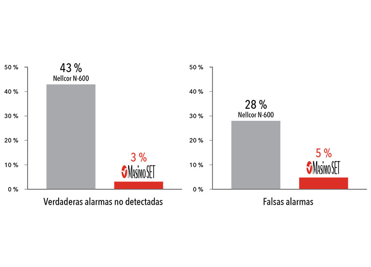 Masimo: gráfico de rendimiento con perfusión baja