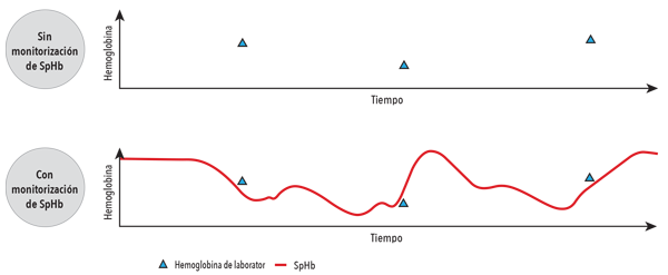 Masimo - SpHb - Gráfico del valor de la monitorización de SpHb