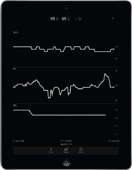 Masimo: datos de tendencias en la aplicación Masimo Professional Health