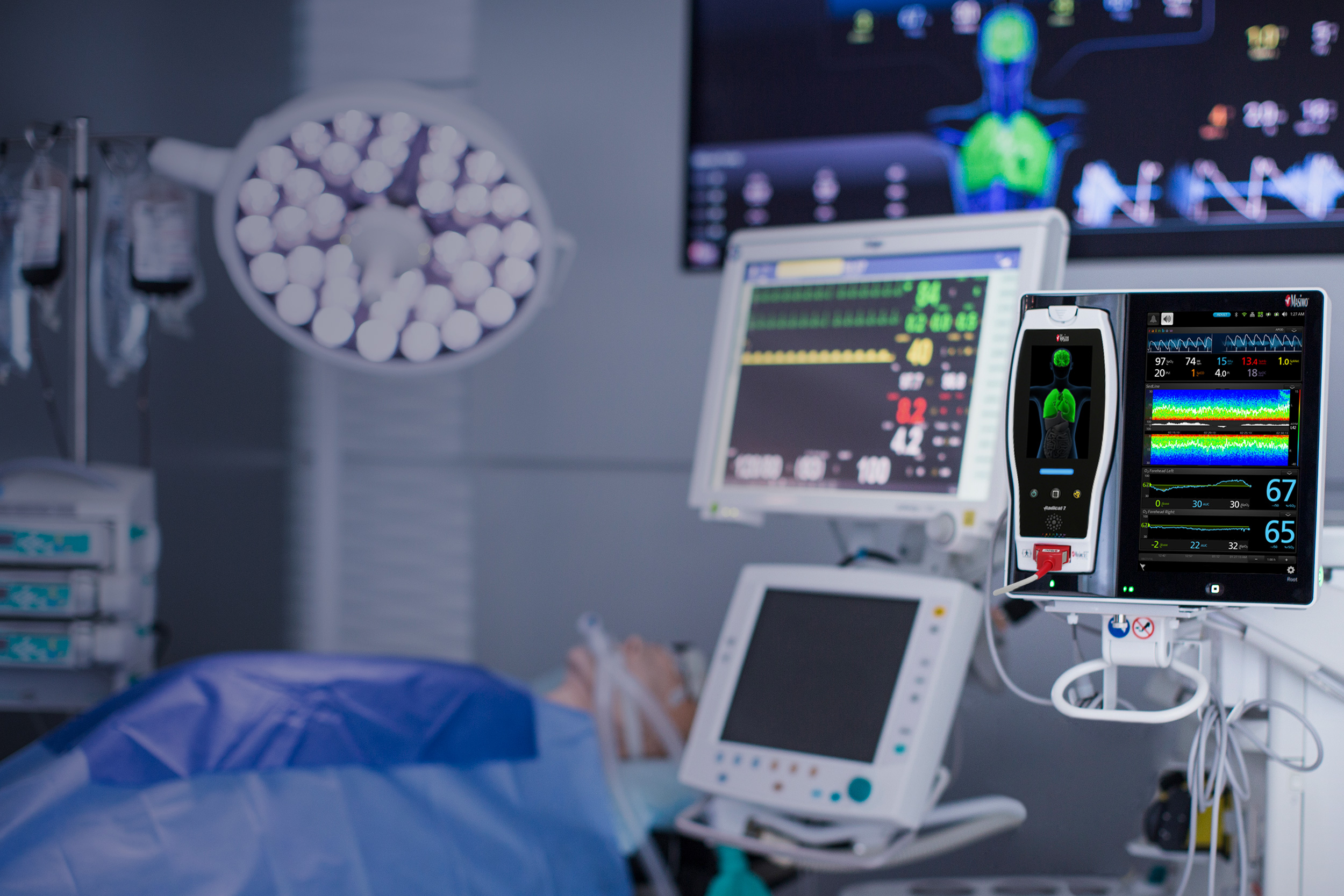 Masimo - Automatización para hospitales