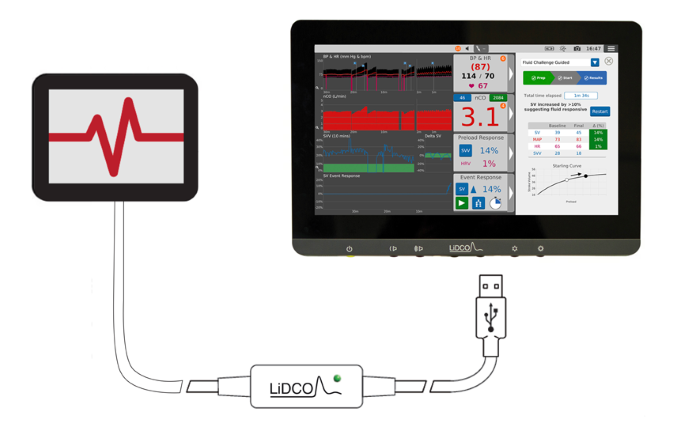 Monitor LiDCO conectado por cable al lector