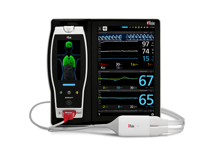 Masimo - Oximetría regional O3®