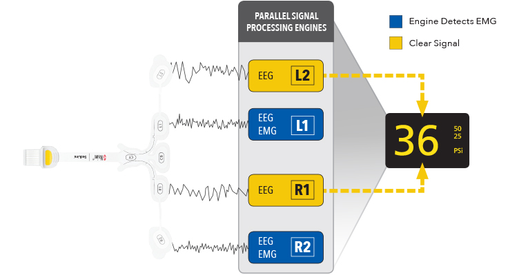 Masimo - Motores de procesamiento de señal en paralelo