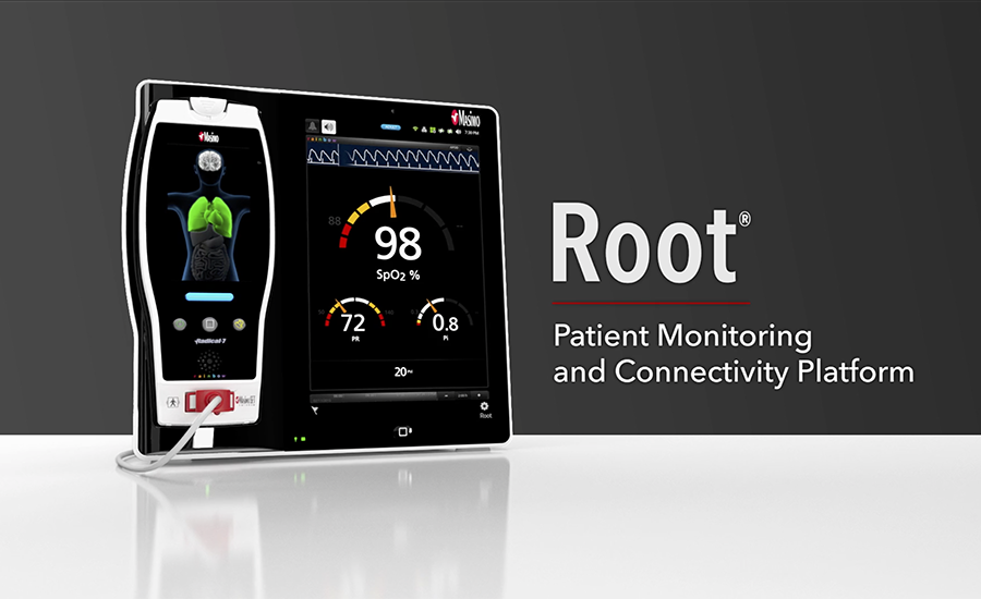 miniatura del vídeo de Root