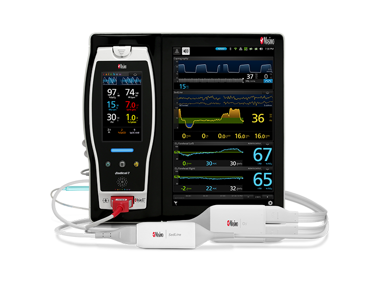 Masimo - Root Capnography SedLine O3 Digital 3-up