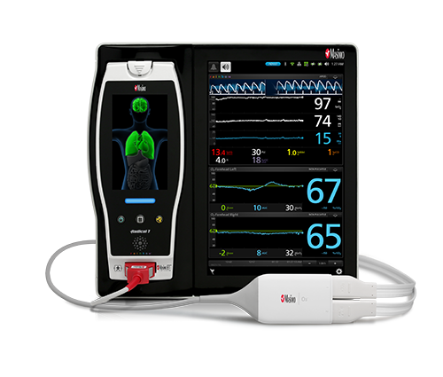 Masimo - Root con imagen del producto Radius PCG sobre fondo liso