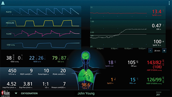 Masimo - UniView - Diseño de oxigenación