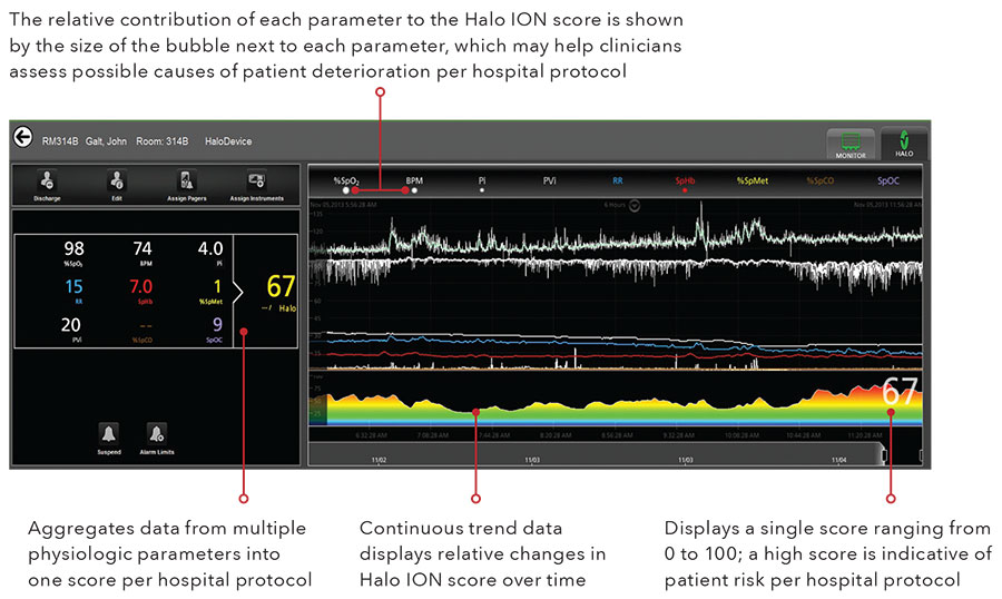 Masimo: un monitor automatizado, personalizado y continuo del estado del paciente