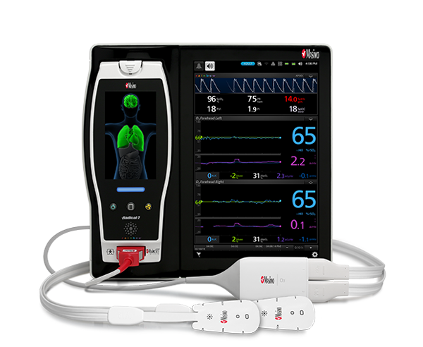 Root Bedside Monitor with O3 Sensors