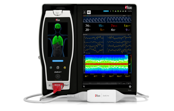 Monitor Root Sedine