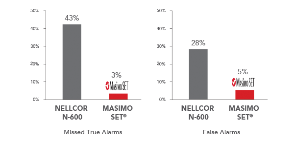 Masimo - Rendimiento de alarma con extracción de señal en condiciones de movimiento y baja perfusión