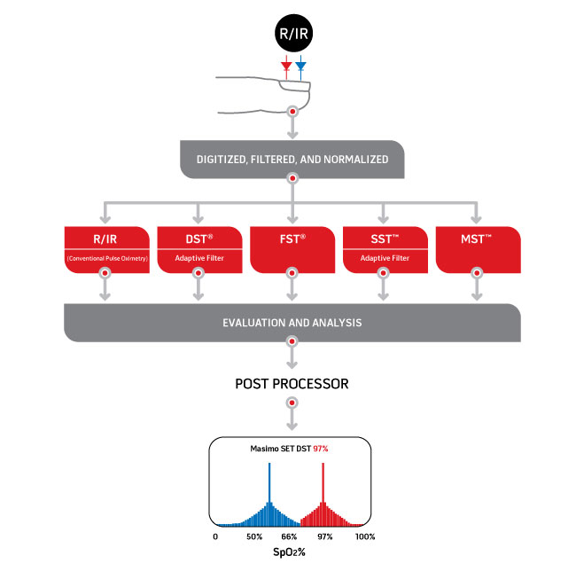 Masimo - Postprocesador, diferencia de Masimo SET